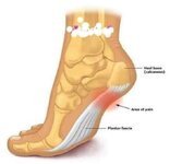 فوائد المشي على رؤوس الأصابع
