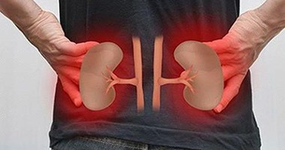 حالات صحية تسبب الفشل الكلوي.. أبرزها الجفاف الشديد