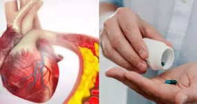 نصائح لخفض نسبة الكوليسترول في الدم.. منها تناول البقوليات