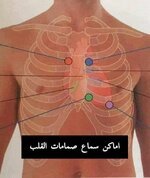 اماكن سماع صمامات القلب. ❣️