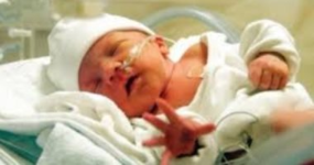 كل ما تريد معرفته عن الولادة المبكرة