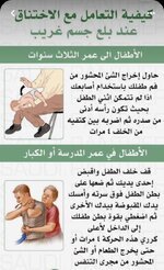 طريقة التعامل مع الشخص عند بلع جسم غريب