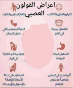 📌أعراض القولون العصبي