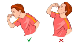🩸الإسعافات الأولية لنزيف الأنف🩸