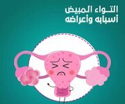 التواء المبيض اسبابه واعراضه.