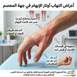 🩺 ألتهاب أوتار الإبهام واعراضه