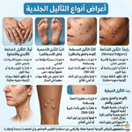 الثآليل وانواع أعراض الثآليل الجلدية