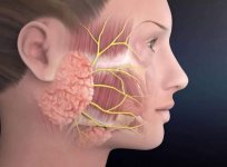 أعراض الغدة النكافية